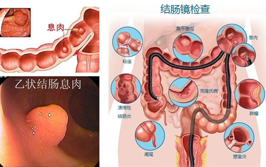 經(jīng)常放屁是在“排毒”？或許“根源”在腸道！